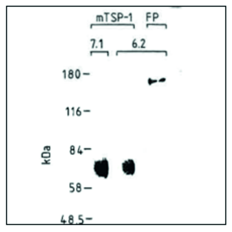 ADG0466L_0467L_Westernblot