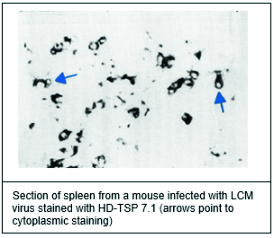 ADG0466L_467L_Immunohistochemistry1