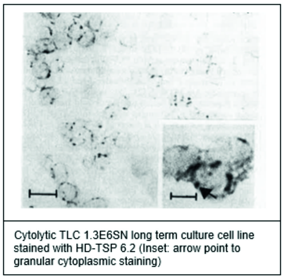 ADG0466L_467L_Immunohistochemistry2