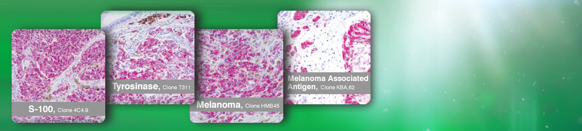 Melanoma-Diagnostics